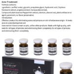 Acne treatment-Stalidearm Meso