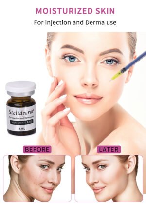 Hyaluronic acid-Stalidearm meso