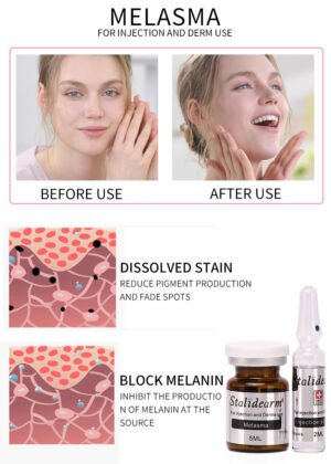 Melasma-5 Melasma Original Stalidearm Injection use Serum