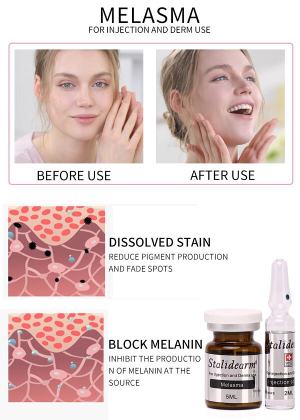 Melasma Original Stalidearm Injection use Serum
